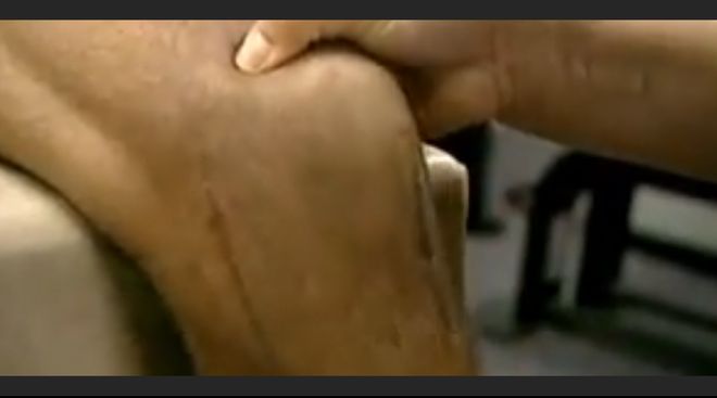 穆迪重伤倒地引唏嘘，利文斯顿伤情回顾显坚韧